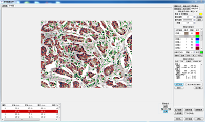  DB-3000显微图像分析软件/生物图像分析软件/细胞统计软件